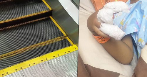 孩子被电扶梯夹 不夹脚趾夹手指？