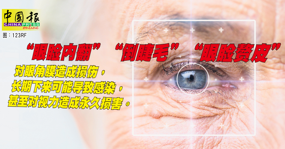 年长者3大眼睛健康问题