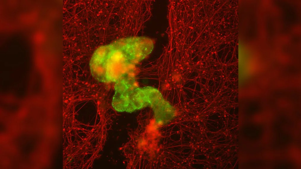 绿色的人类机器人在红色的神经元组织刮痕上生长。