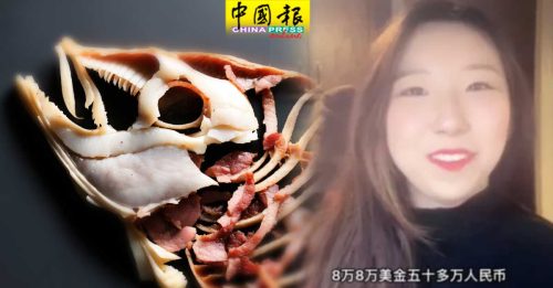 中国女留学生鱼刺卡喉咙 入美国医院动手术 收天价帐单