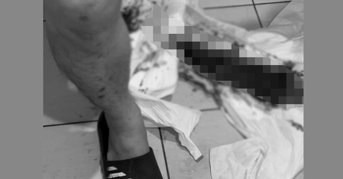男子控诉被医务人员粗暴拔出尿管，导致其尿道大量出血。