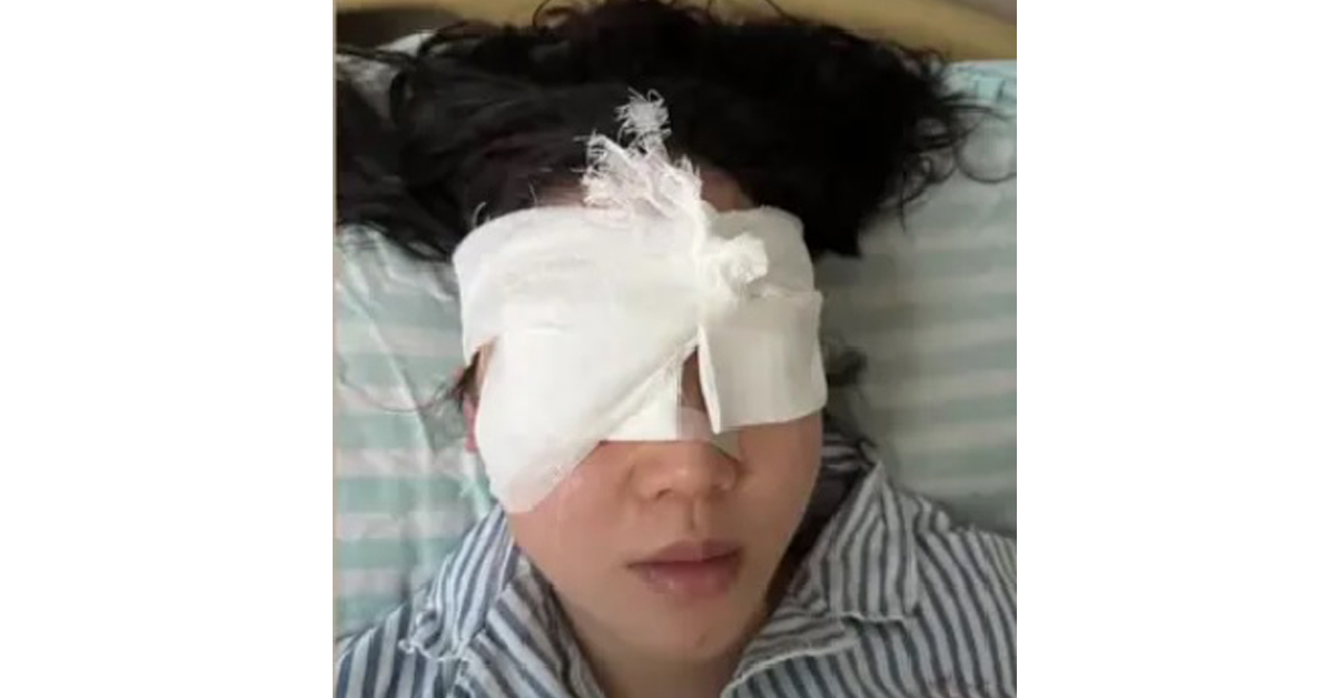 眼睛受伤的黄女士，在医院接受治疗。