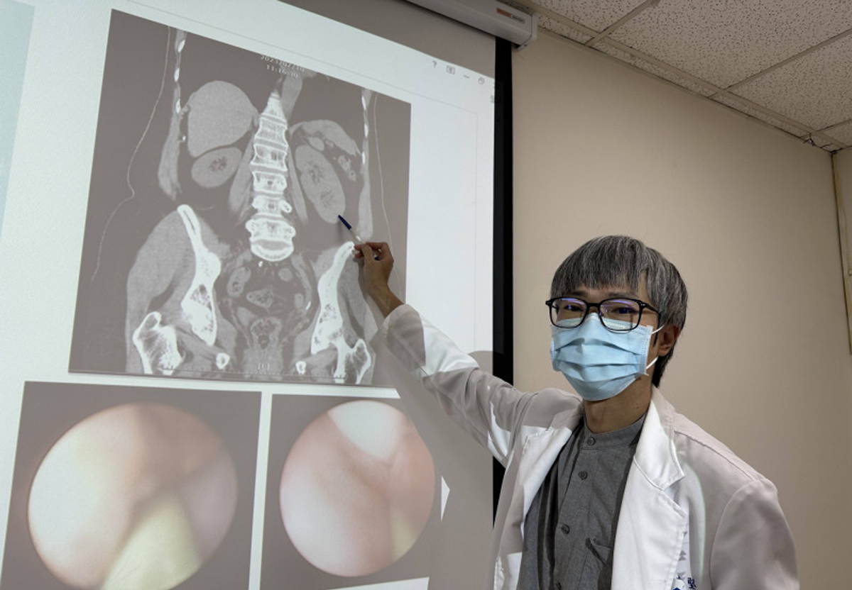 赵浩坚指出，张妇左侧有两颗肾脏及两条完整的输尿管，为“单侧双套集尿系统”，她先天有3颗肾脏。