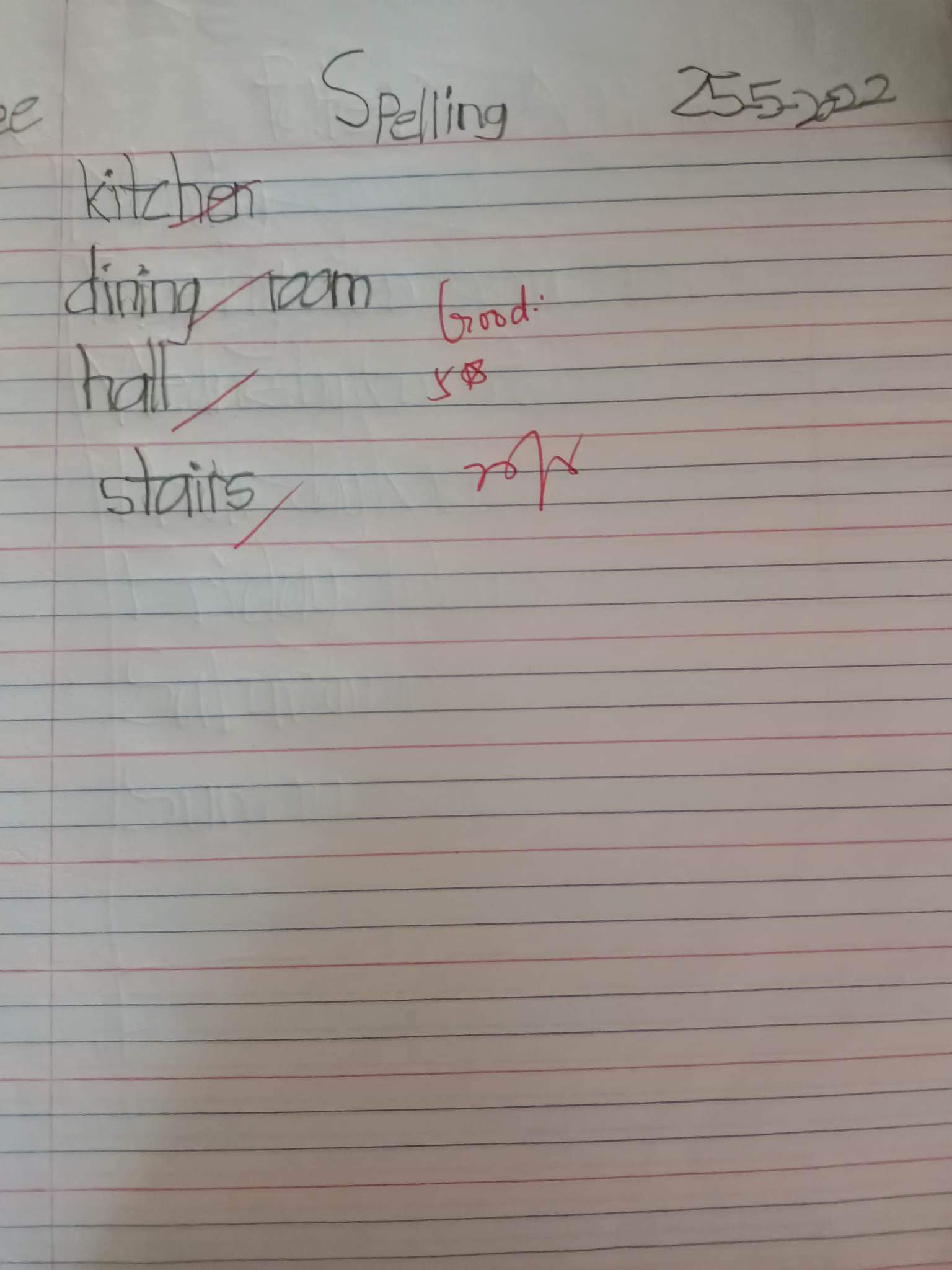 小妮手术后右眼充血，视力随后不升反降。（黄美琪提供）