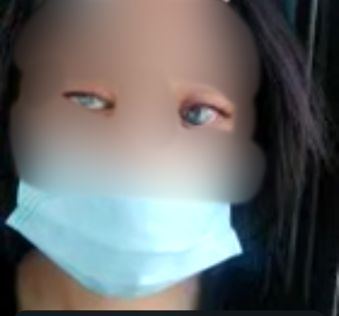 小妮直到最近，近乎失明的视力依然没有好转。（黄美琪提供）