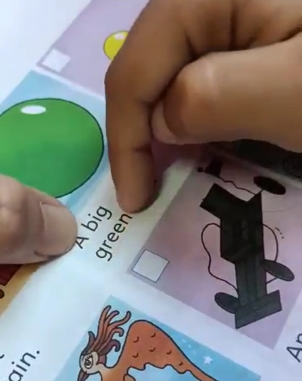 小妮手术前虽然视力模糊，但依然能够辨认字体。