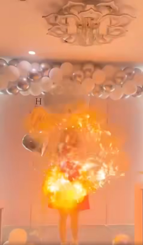 派对 氢气球爆炸 女子生日 惨破相｜附音频