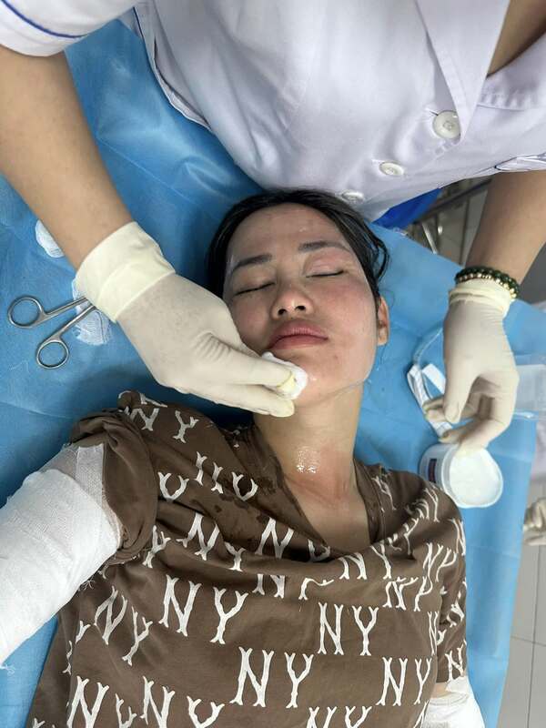 派对 氢气球爆炸 女子生日 惨破相｜附音频