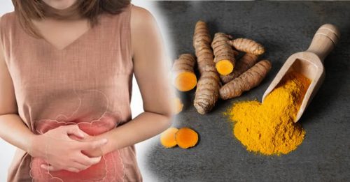 妇大肠癌末期 连吃3月姜黄肿瘤变小