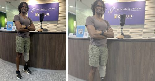 车祸碾断腿动14次手术 教练装义肢重返健身房