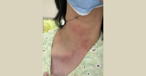 不拾试卷引冲突 高中生勒伤女老师