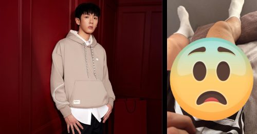 柯震东严重烫伤 大腿包扎惨况曝光