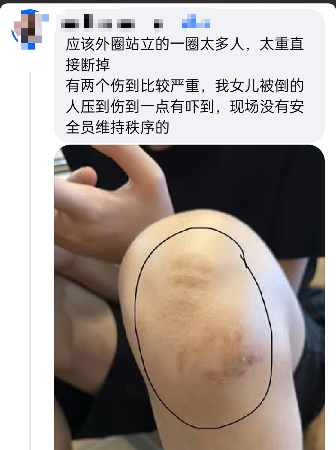 其中一名伤者称游乐设施突然断裂，其中2人伤势较重。