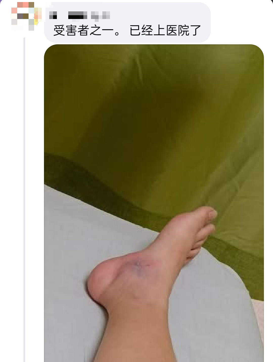 其中一名伤者称已入院治疗。