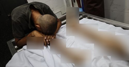 当地体育冠军 17岁男孩饿死加萨