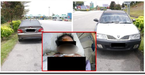 疑感情纠纷 男子纵火烧伤女友