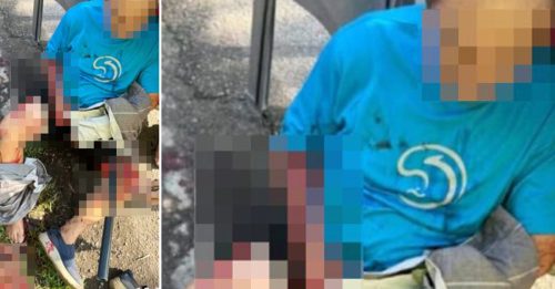 家门前遭前邻居持刀狂砍 六旬老翁 拇指断 右脚截肢