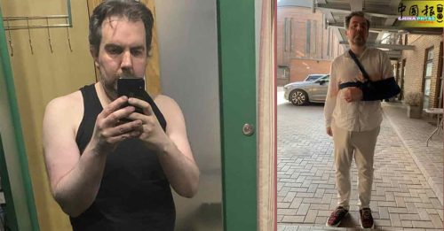 37公分！男子巨雕挡住视线 结果洗澡滑倒骨折