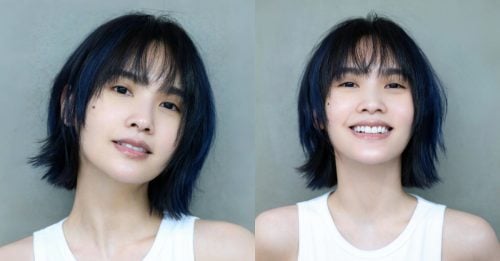 消失数月 杨丞琳亲曝动大手术