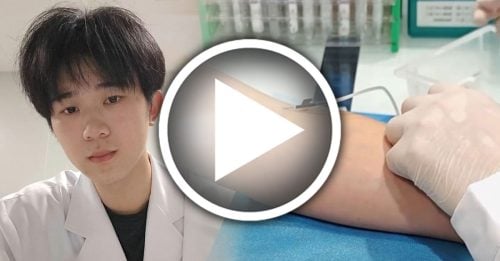 男0.6秒“飞针”抽血 快到病人无痛感