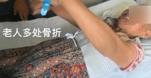 养老院院长母亲虐打失智妇 肋骨胸椎多处骨折兼脑梗