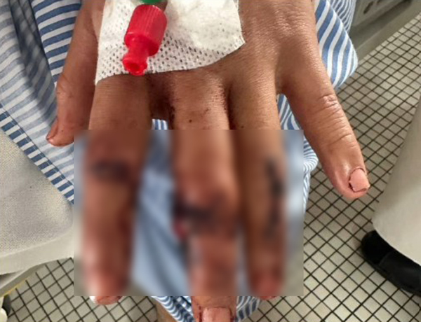 青年的手指全是血迹。