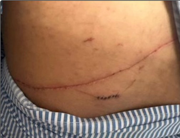 青年身上都是伤痕和瘀青。