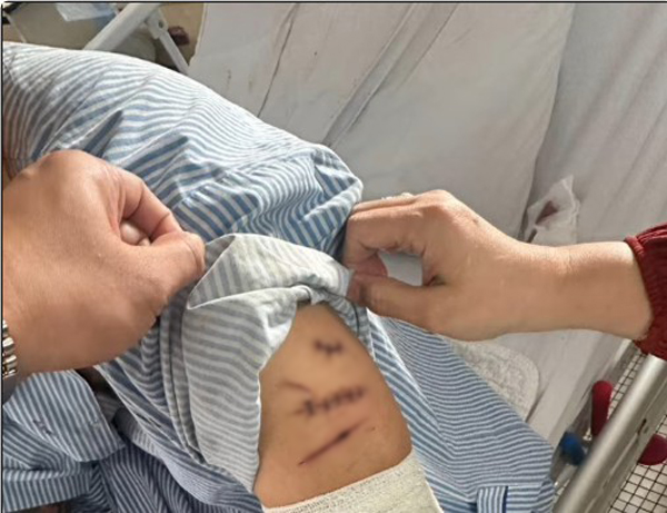 青年身上都是伤痕和瘀青。