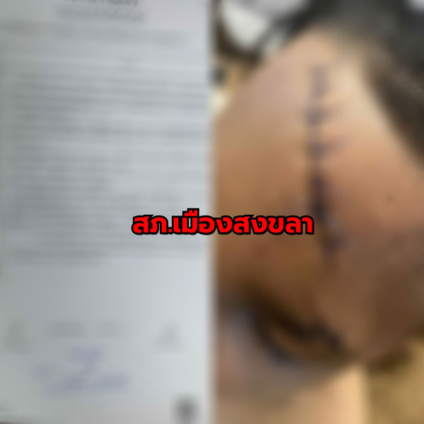 接连发生 随机伤人 宋卡合艾 人心惶惶