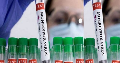 日本出现M痘重症首例 20多岁女有非洲旅游史