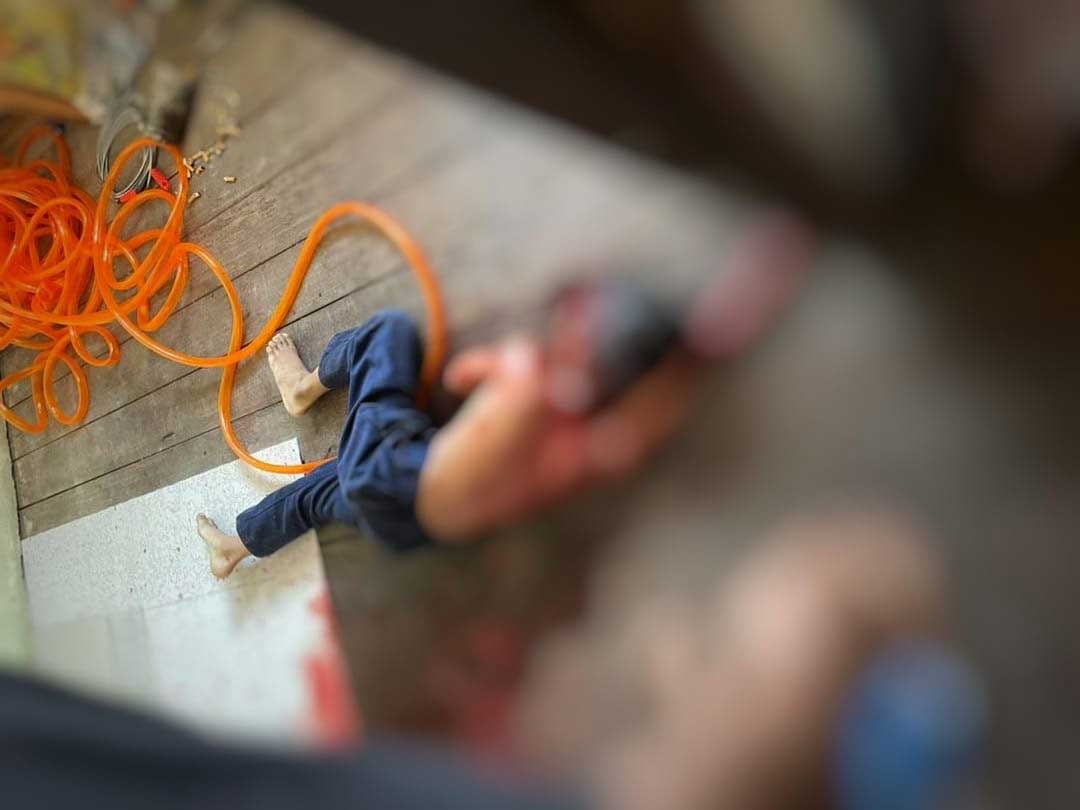 男童头部被打至受重伤。