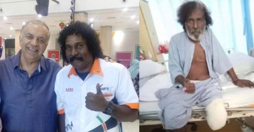 喜剧演员因病截肢 Mydin老板暖心允援