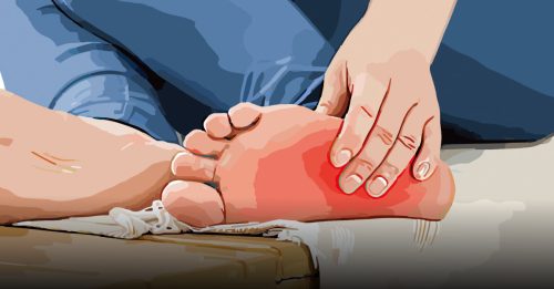 健康百科｜改善足底筋膜炎 从日常做起