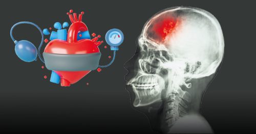 健康百科｜遵循新指南 轻松维持健康血压