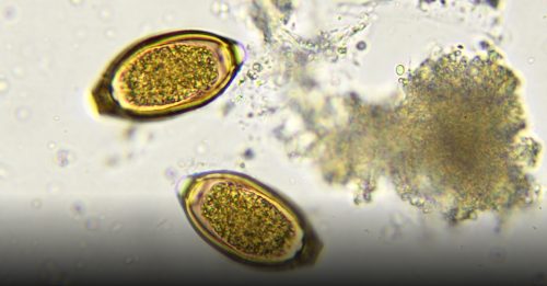 健康百科｜男人成滴虫感染无声传播者