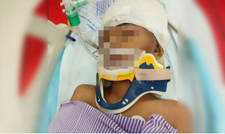 7岁男童重伤在医院治疗。