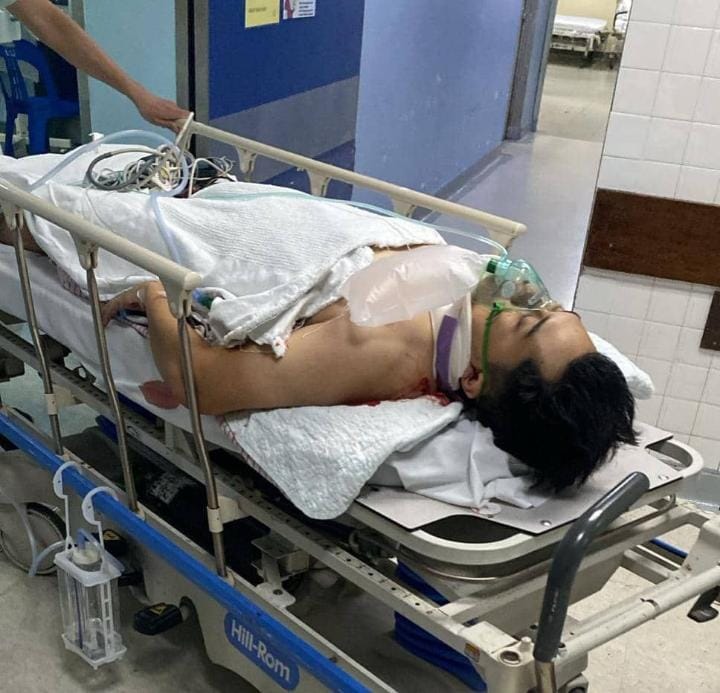 腹部受伤的阿兹祖基菲里，目前情况稳定。