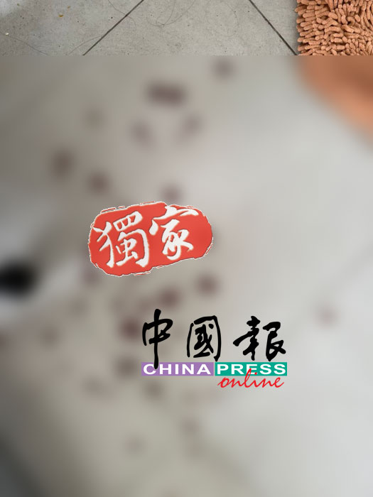 乔小姐被割伤颈部后血流如注，鲜血遍布地面。