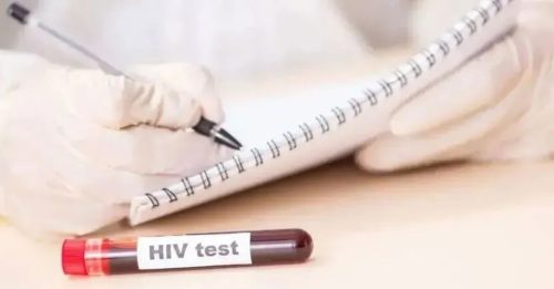 四川现首宗HIV-2病例 感染者是67岁女性