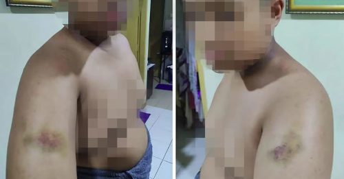 上缴保护费仍遭流氓学长围殴 15岁学生不敢上学