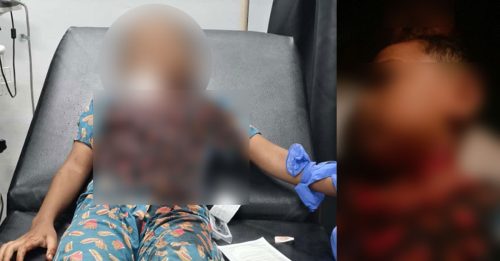 男童疑遭利器割颈｜手术后可开口说话 警未向男童取口供