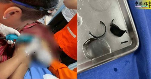 男忧尺寸太大被偷 用两环锁住 肿到急送医