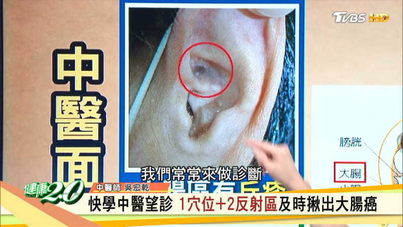 耳朵“大肠区”出现丘疹，颜色呈现焦黑。
