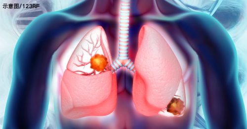 政府征电子烟税收2亿 治疗肺损伤却花2亿2350万