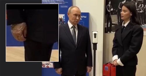 普汀右手肿胀凸青筋 再传健康亮红灯！