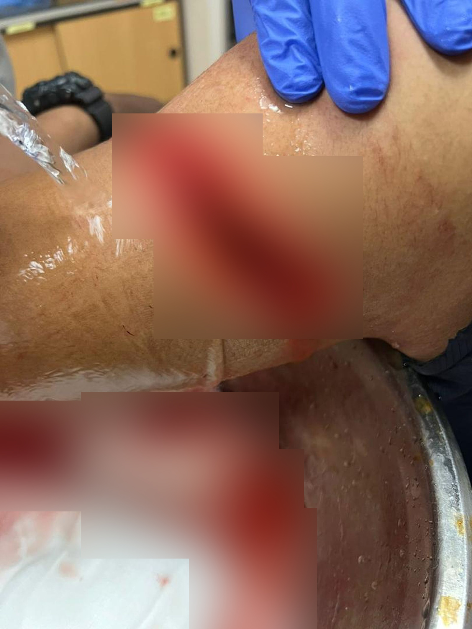 遭砍伤的警员左手臂似乎深可见骨。（图警方提供）