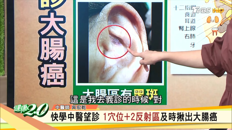 另一患者出现黑斑。
