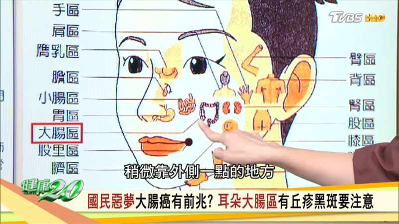 脸部大肠区出现大块黑斑可能是大肠癌。
