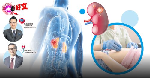 看好文：顾名思医｜肾癌无迹可寻？错！远离病魔有办法