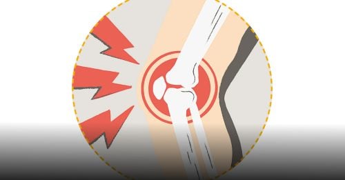 健康百科｜预防关节提前老化 饮食至关重要